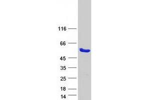 Validation with Western Blot