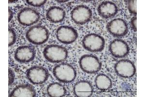 Immunoperoxidase of monoclonal antibody to SUPT5H on formalin-fixed paraffin-embedded human colon.