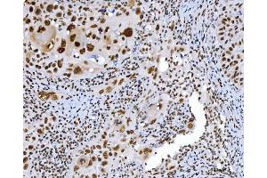 IHC analysis of C1orf77/FOP/CHTOP using anti-C1orf77/FOP/CHTOP antibody (ABIN7603201). (CHTOP anticorps  (N-Term))