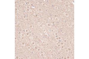 Immunohistochemistry of paraffin-embedded mouse brain using VEGF Receptor 2 antibody (ABIN6132247, ABIN6142816, ABIN6142819 and ABIN6215074) at dilution of 1:100 (40x lens).