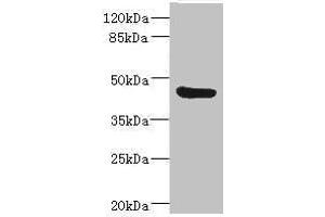 Western blot All lanes: BAAT antibody IgG at 3. (BAAT anticorps  (AA 309-418))