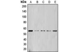 Western blot analysis of Cyclin L1 expression in HL60 (A), NIH3T3 (B), Jurkat (C), THP1 (D), K562 (E) whole cell lysates. (Cyclin L1 anticorps  (C-Term))