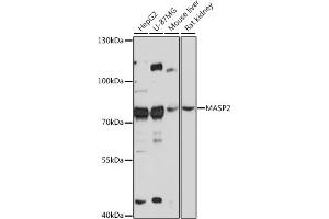 Western blot analysis of extracts of various cell lines, using M antibody (ABIN7268387) at 1:3000 dilution. (MASP2 anticorps  (AA 445-686))