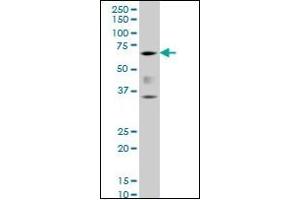 Western Blotting (WB) image for anti-Runt-Related Transcription Factor 2 (RUNX2) (AA 251-351) antibody (ABIN614586) (RUNX2 anticorps  (AA 251-351))