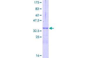 Image no. 1 for Nerve Growth Factor Receptor (TNFRSF16) Associated Protein 1 (NGFRAP1) (AA 1-101) protein (GST tag) (ABIN1312535)