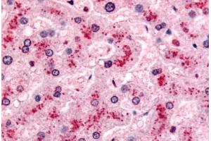 Human Liver (formalin-fixed, paraffin-embedded) stained with PYGL antibody ABIN213380 at 10 ug/ml followed by biotinylated goat anti-rabbit IgG secondary antibody ABIN481713, alkaline phosphatase-streptavidin and chromogen.