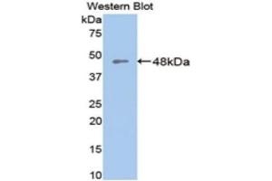 Western Blotting (WB) image for anti-Glutamic-Oxaloacetic Transaminase 1, Soluble (Aspartate Aminotransferase 1) (GOT1) (AA 1-413) antibody (ABIN1077844)