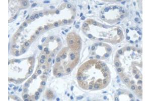 DAB staining on IHC-P; Samples: Human Kidney Tissue (IARS anticorps  (AA 1-500))