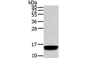 Western Blot analysis of Human normal prostate tissue using VAMP5 Polyclonal Antibody at dilution of 1/650 (VAMP5 anticorps)