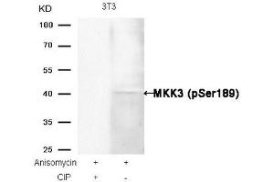 Western blot analysis of extracts from 3T3 cells, treated with Anisomycin or calf intestinal phosphatase (CIP), using MKK3 (Phospho-Ser189) Antibody. (MAP2K3 anticorps  (pSer189))