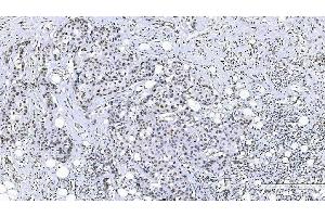 IHC analysis of FOXK1 using anti-FOXK1 antibody (ABIN7600295). (Foxk1 anticorps  (AA 175-671))
