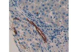 Used in DAB staining on fromalin fixed paraffin- embedded Kidney tissue (HCK anticorps  (AA 2-526))