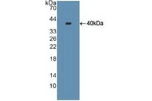 Detection of Recombinant S17aH, Human using Polyclonal Antibody to Cytochrome P450 17A1 (CYP17A1)