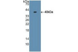 Detection of Recombinant S17aH, Human using Polyclonal Antibody to Cytochrome P450 17A1 (CYP17A1) (CYP17A1 anticorps  (AA 183-508))
