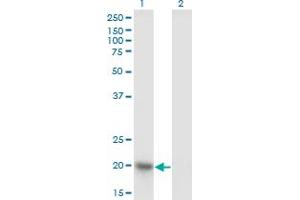 Western Blot analysis of NDUFAB1 expression in transfected 293T cell line by NDUFAB1 monoclonal antibody (M06), clone 2D10.