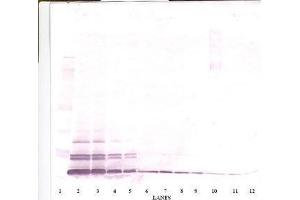 Image no. 1 for anti-Chemokine (C-C Motif) Ligand 26 (CCL26) antibody (ABIN465090) (CCL26 anticorps)