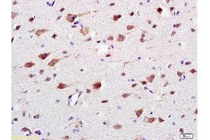 Formalin-fixed and paraffin embedded: rat brain tissue labeled with Anti-CaMK2b Polyclonal Antibody , Unconjugated at 1:200 followed by conjugation to the secondary antibody and DAB staining (CAMK2B anticorps  (AA 1-100))