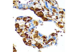 Immunohistochemistry of paraffin-embedded human placenta using HBG1 Rabbit mAb (ABIN1679149, ABIN1679148, ABIN7101336 and ABIN7101337) at dilution of 1:100 (40x lens). (HBG1/2 anticorps)