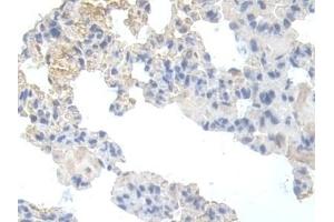 Detection of PFKM in Rat Lung Tissue using Polyclonal Antibody to Phosphofructokinase, Muscle (PFKM)