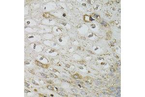 Immunohistochemistry of paraffin-embedded human esophagus using SERPINA1 antibody.