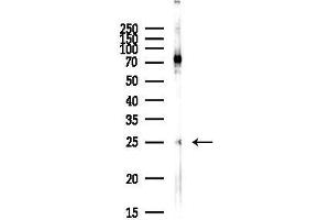 anti-Claudin 8 (CLDN8) (C-Term) antibody