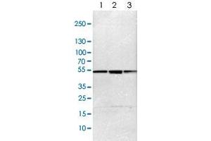 Western blot analysis of Lane 1: NIH-3T3 cell lysate (Mouse embryonic fibroblast cells), Lane 2: NBT-II cell lysate (Rat Wistar bladder tumour cells), Lane 3: PC12 cell lysate (Pheochromocytoma of rat adrenal medulla) with PSMC4 polyclonal antibody  at 1:100-1:500 dilution.