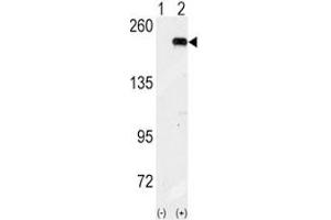 Western blot analysis of GCN2 antibody and 293 cell lysate (2 ug/lane) either nontransfected (Lane 1) or transiently transfected with the GCN2 gene (2). (GCN2 anticorps  (AA 1-30))