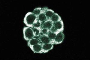 Immunofluorescent staining of WIDR cells. (Dynamitin anticorps  (AA 55-196))