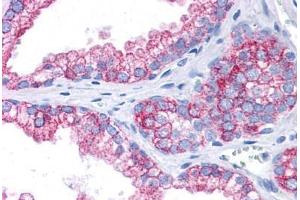 anti-erythrocyte Membrane Protein Band 4.1-Like 2 (EPB41L2) (AA 481-530) antibody