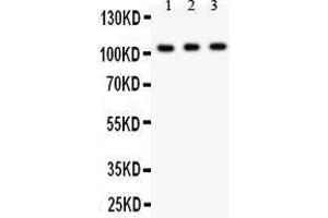Anti- GRIK1 antibody, Western blotting All lanes: Anti GRIK1  at 0. (GRIK1 anticorps  (AA 271-450))