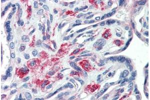 Human Placenta (formalin-fixed, paraffin-embedded) stained with STX12 antibody ABIN364383 at 20 ug/ml followed by biotinylated anti-mouse IgG secondary antibody ABIN481714, alkaline phosphatase-streptavidin and chromogen.
