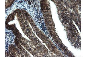 Image no. 4 for anti-Tubulin Folding Cofactor C (TBCC) antibody (ABIN1501323)