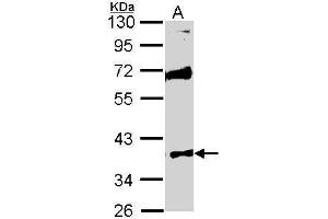 WB Image Sample (30 ug of whole cell lysate) A: Raji 10% SDS PAGE antibody diluted at 1:1000 (STK26/MST4 anticorps  (Center))