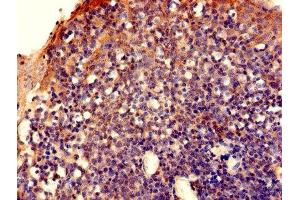 Immunohistochemistry of paraffin-embedded human tonsil tissue using ABIN7152377 at dilution of 1:100 (CAPZA2 anticorps  (AA 2-286))