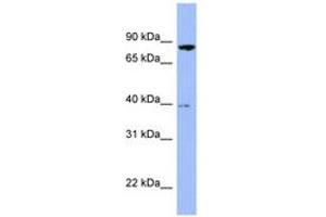 Image no. 1 for anti-Radixin (RDX) (AA 467-516) antibody (ABIN6741663) (Radixin anticorps  (AA 467-516))