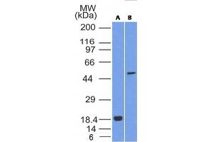 Western Blot Analysis of SOX10 (A) Recombinant protein; (B) A375 cell lysate using SOX10 Mouse Monoclonal Antibody (SOX10/1074). (SOX10 anticorps  (AA 115-269))