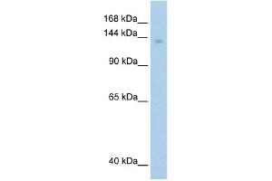 WB Suggested Anti-MOV10 Antibody Titration:  1. (MOV10 anticorps  (C-Term))