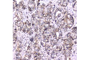IHC analysis of RAB27A using anti-RAB27A antibody .