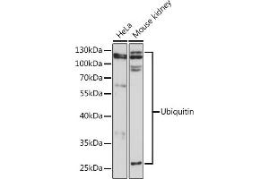 Western blot analysis of extracts of various cell lines, using Ubiquitin pAb  at 1:3000 dilution. (Ubiquitin B anticorps)