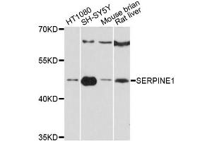 Western blot analysis of extracts of various cell lines, using SERPINE1 antibody (ABIN5998780) at 1:3000 dilution. (PAI1 anticorps)