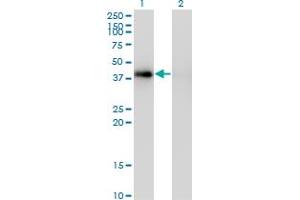 Western Blot analysis of PCYT1A expression in transfected 293T cell line by PCYT1A monoclonal antibody (M03), clone 7H8. (PCYT1A anticorps  (AA 2-90))