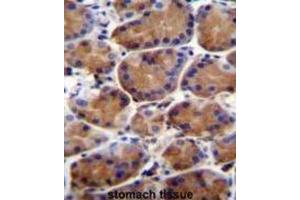 Immunohistochemistry (IHC) image for anti-Leucine-Rich Repeat and WD Repeat-Containing Protein 1 (LRWD1) antibody (ABIN2996388) (LRWD1 anticorps)