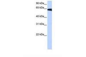 Image no. 1 for anti-Phosphatidylinositol Glycan W (PIGW) (AA 264-313) antibody (ABIN6739249) (PIGW anticorps  (AA 264-313))