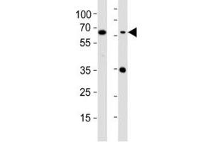 Western blot testing of CD63 antibody at 1:1000 dilution.