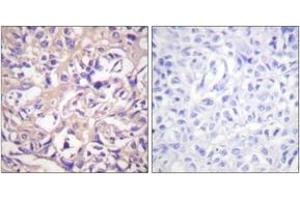 Immunohistochemistry (IHC) image for anti-Thymidine Kinase 1, Soluble (TK1) (AA 1-50) antibody (ABIN2888706) (TK1 anticorps  (AA 1-50))