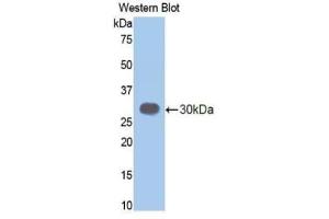 Detection of Recombinant ELA3B, Mouse using Polyclonal Antibody to Elastase 3B (ELA3B)