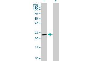 Western Blot analysis of TPD52L1 expression in transfected 293T cell line by TPD52L1 MaxPab polyclonal antibody. (TPD52L1 anticorps  (AA 1-204))