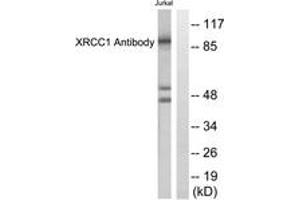 Western blot analysis of extracts from Jurkat cells, using XRCC1 Antibody. (RCC1 anticorps  (AA 517-566))