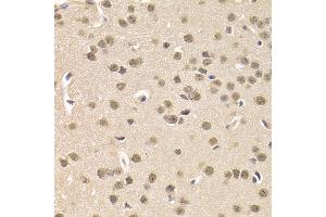 Immunohistochemistry of paraffin-embedded mouse brain using CSNK1E Antibody. (CK1 epsilon anticorps)