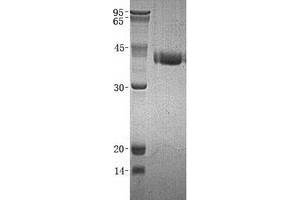 Validation with Western Blot (Kallikrein 11 Protein (KLK11) (His tag))